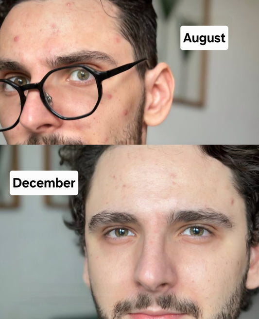 Before / After