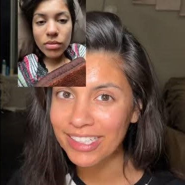 Cortisol Face: What It Is and How to Address It