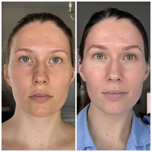 Tired eyes? This routine changed everything