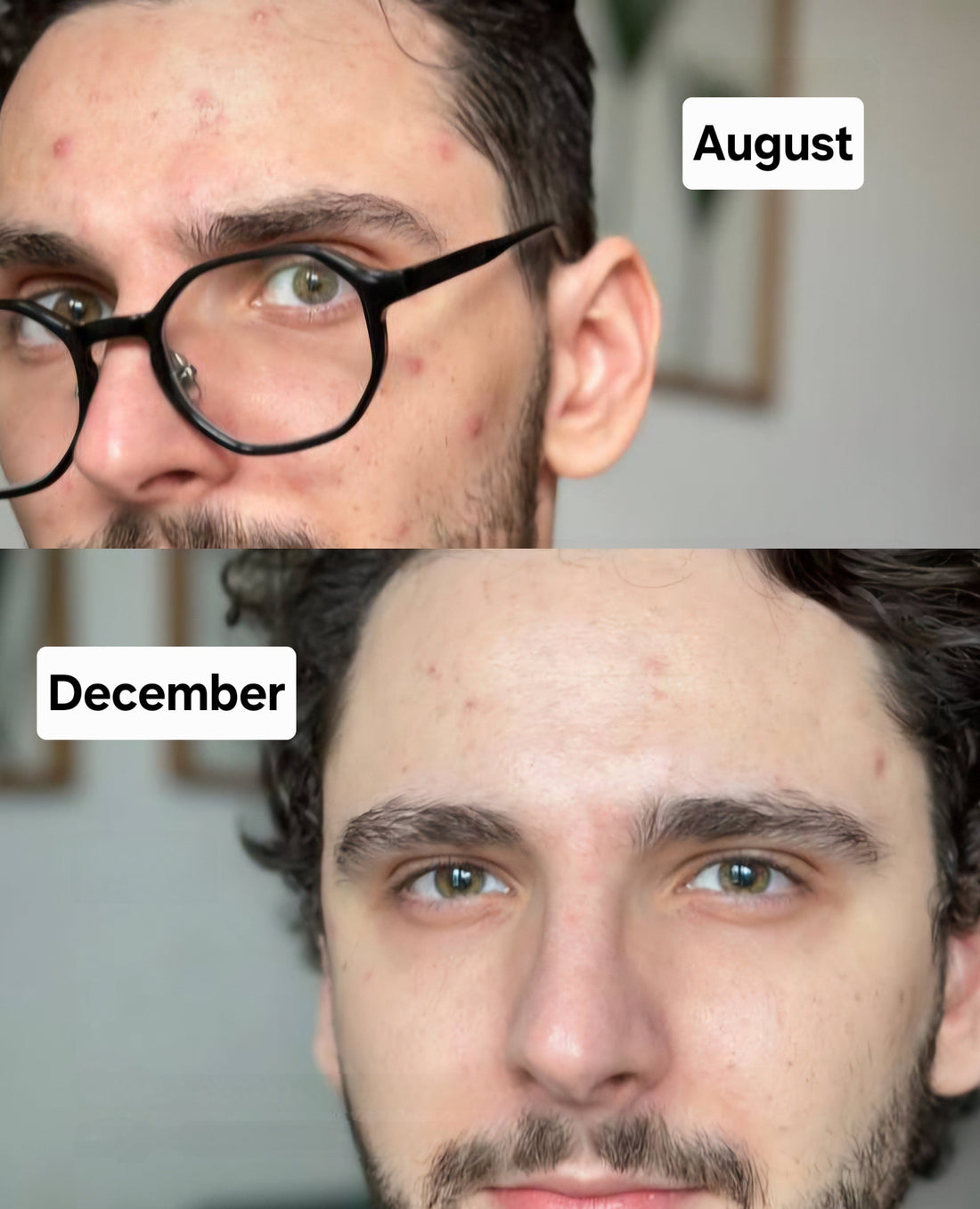 Before / After